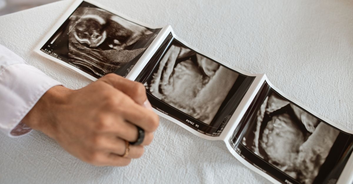 Cud życia tydzień po tygodniu: przewodnik po wczesnym rozwoju Twojego maluszka